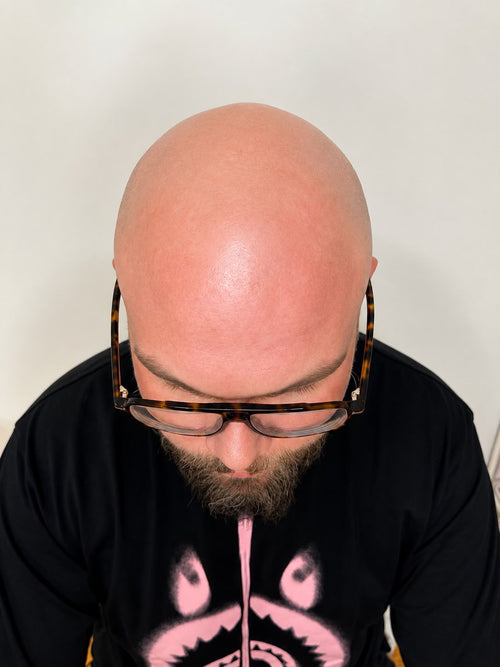 Person wearing glasses and a black shirt with a graphic design, looking downwards.